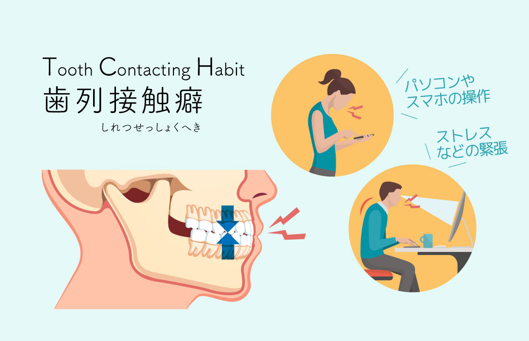 コロナ禍の心と身体のSOSは“歯と顎”にあらわれる!?