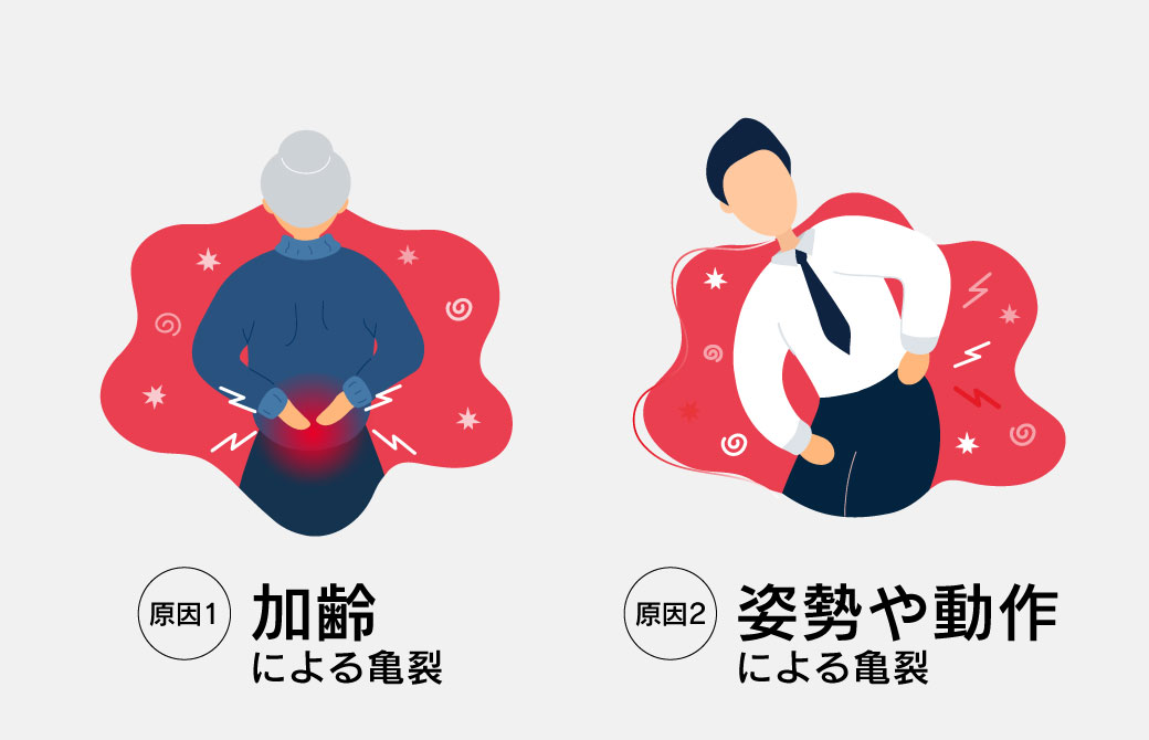 腰椎椎間板ヘルニアの主な原因2つ
