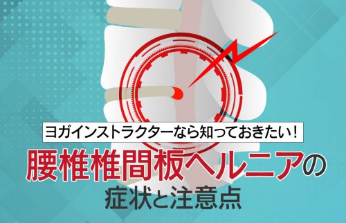 ヨガを指導する際に知っておきたい「腰椎椎間板ヘルニア」の症状と注意点