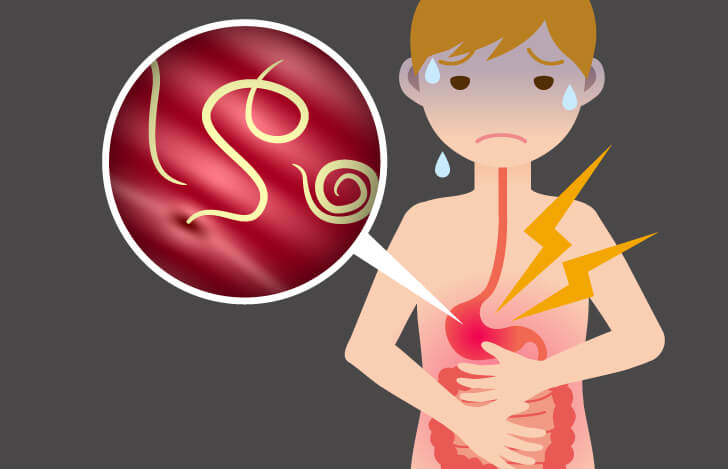 アニサキスによる食中毒を起こした人の体