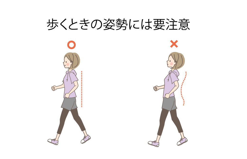 スポーツ医学アカデミー反り腰で歩く人