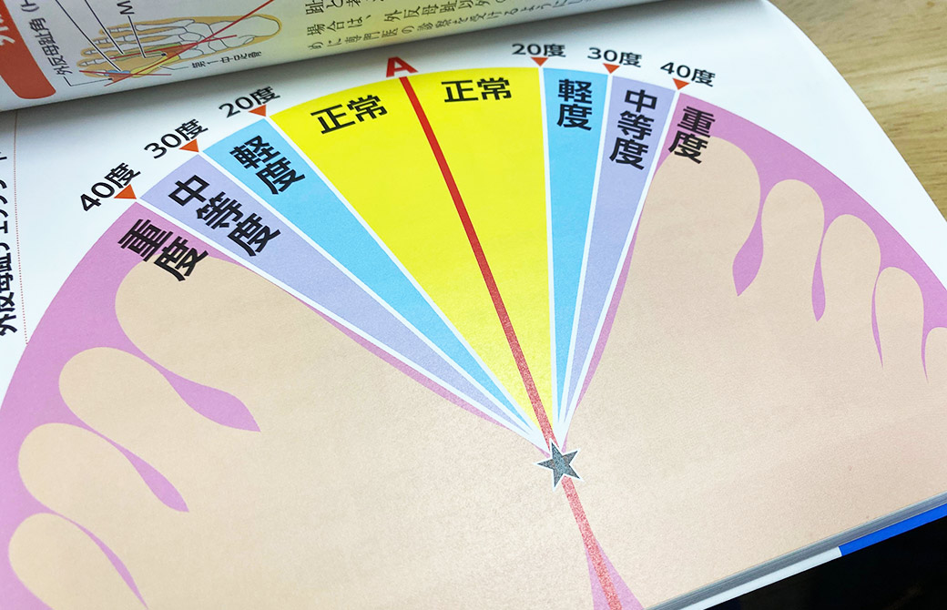 実際に足を乗せて自分の足をセルフチェック！